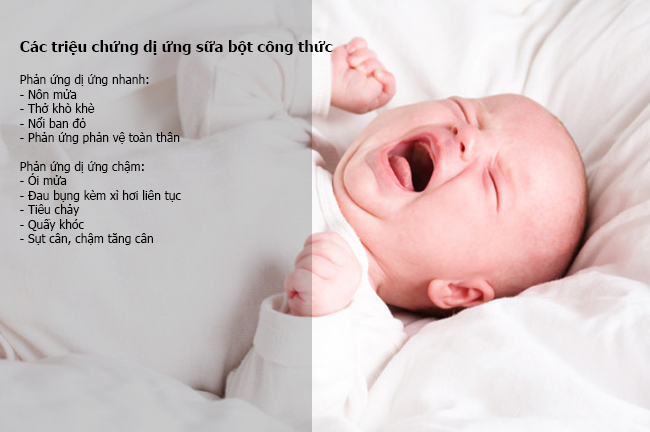 Dị ứng sữa công thức: Nguyên nhân, triệu chứng và biện pháp điều trị (3)