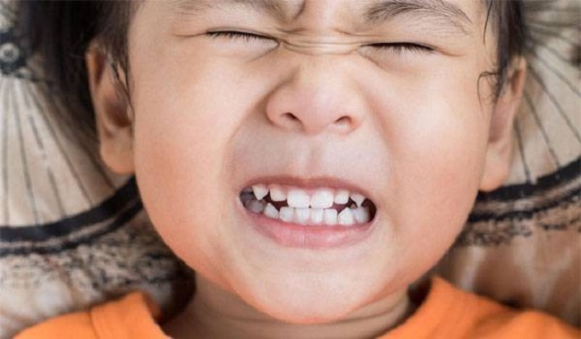 Hỏi đáp về tật nghiến răng khi ngủ ở trẻ nhỏ (1)